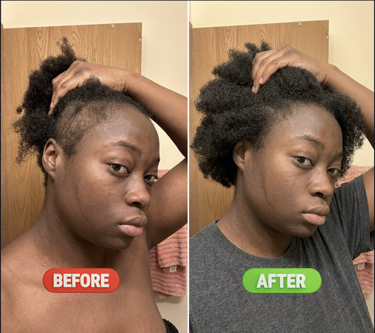 Before and After Results
