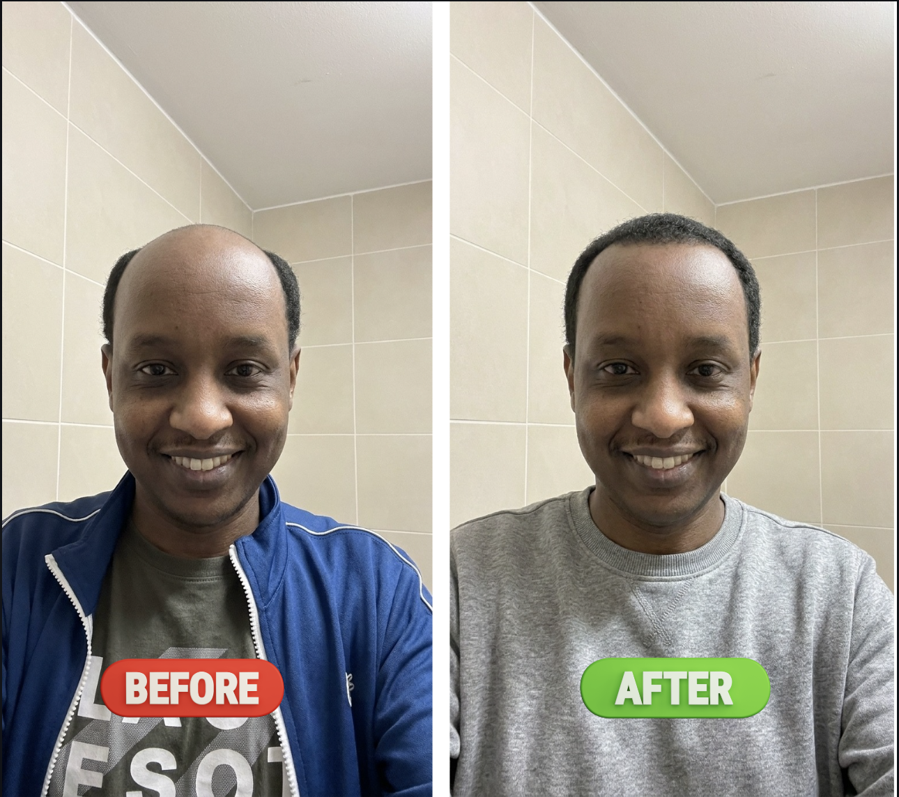 Before and After Results