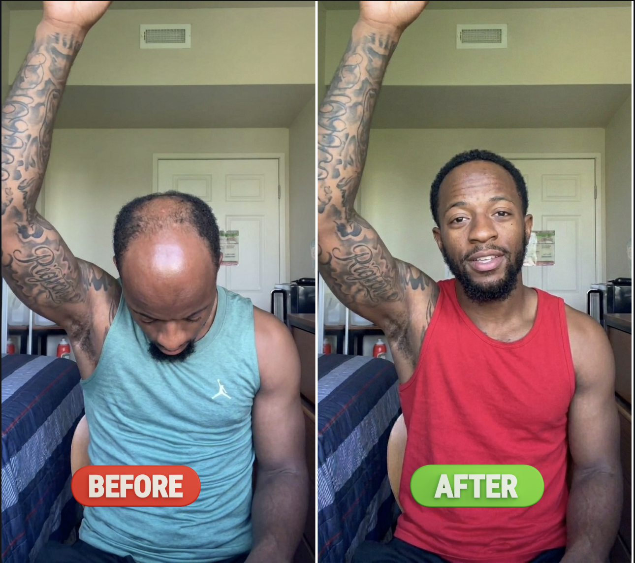 Before and After Results